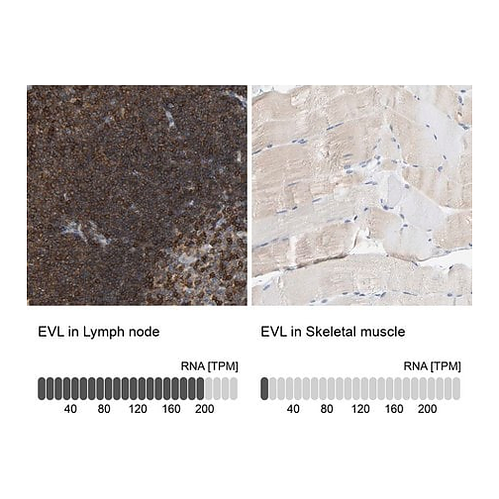 Merck Anti-EVL antibody produced in rabbit