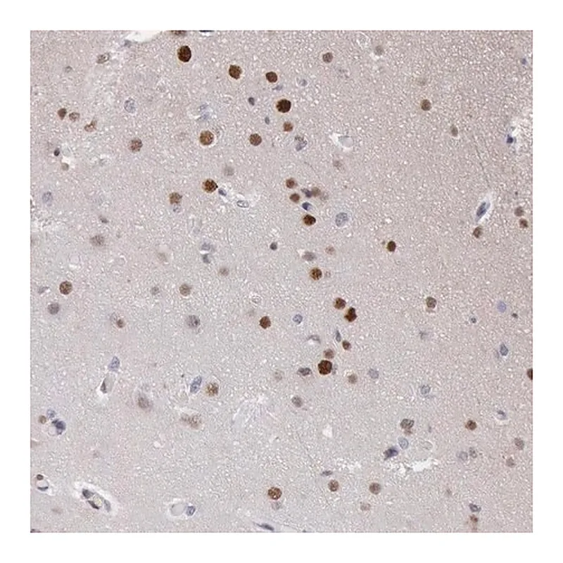 Merck Anti-RPS6KA5 antibody produced in rabbit