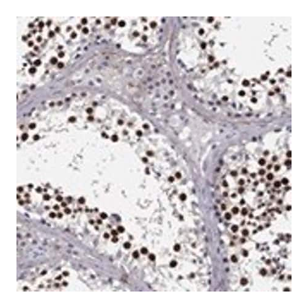 Merck Anti-REXO5 antibody produced in rabbit