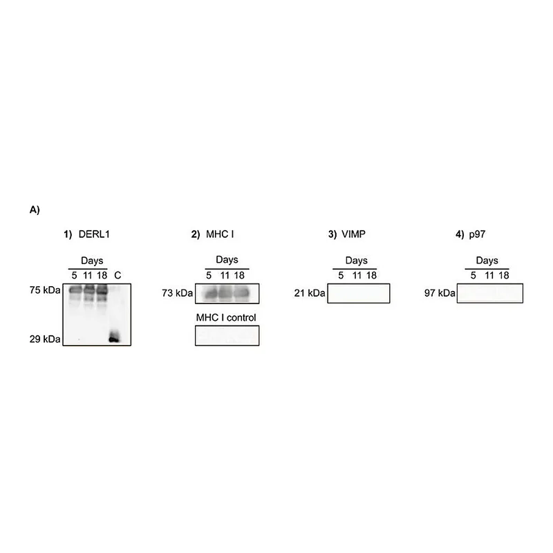Merck Anti-Derlin-1 antibody produced in rabbit