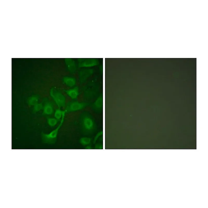 Merck Anti-TIMP2 antibody produced in rabbit