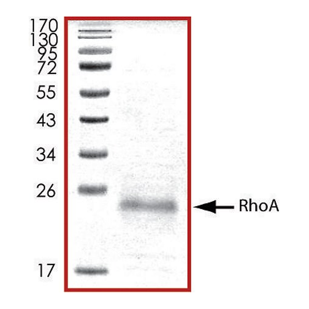 Merck RhoA, His tagged human