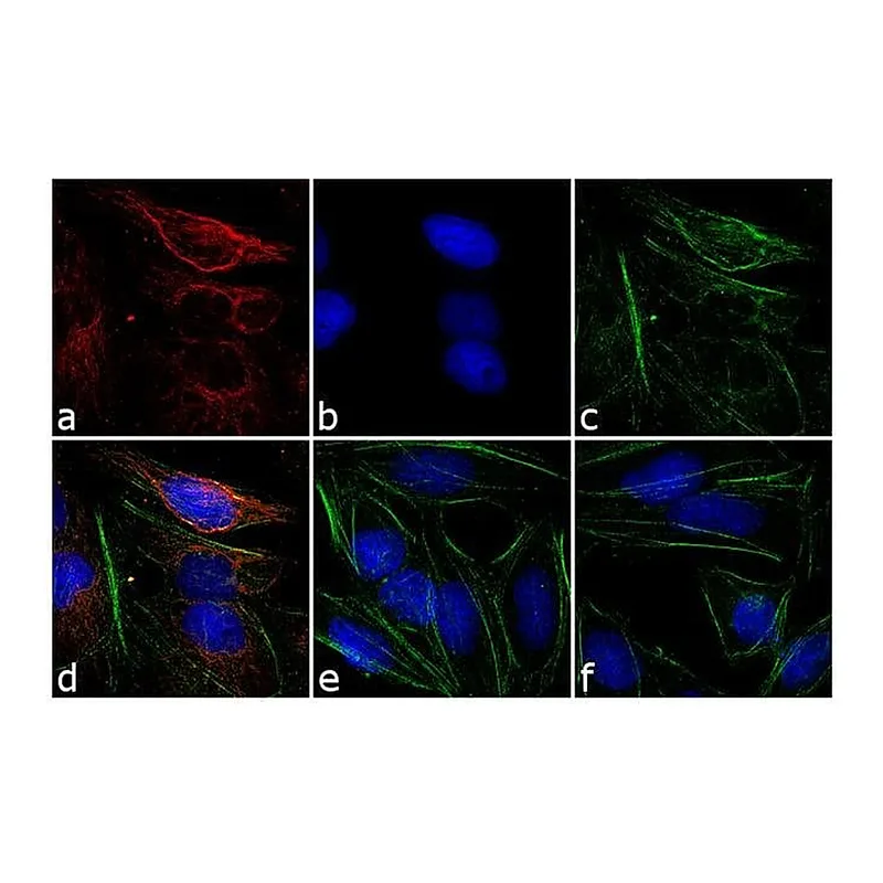 Thermo Fisher Scientific Goat anti-Mouse IgG (H+L) Cross-Adsorbed Secondary Antibody, Rhodamine