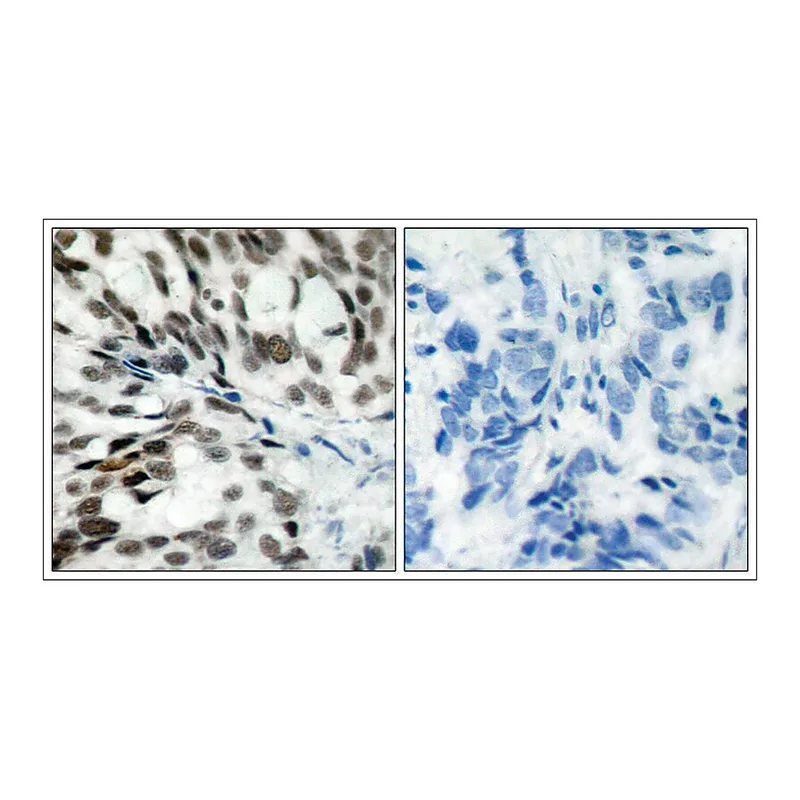 Merck Anti-RB1 (Ab-780) antibody produced in rabbit