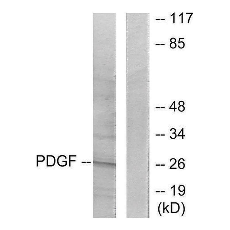 Merck Anti-PDGFB antibody produced in rabbit