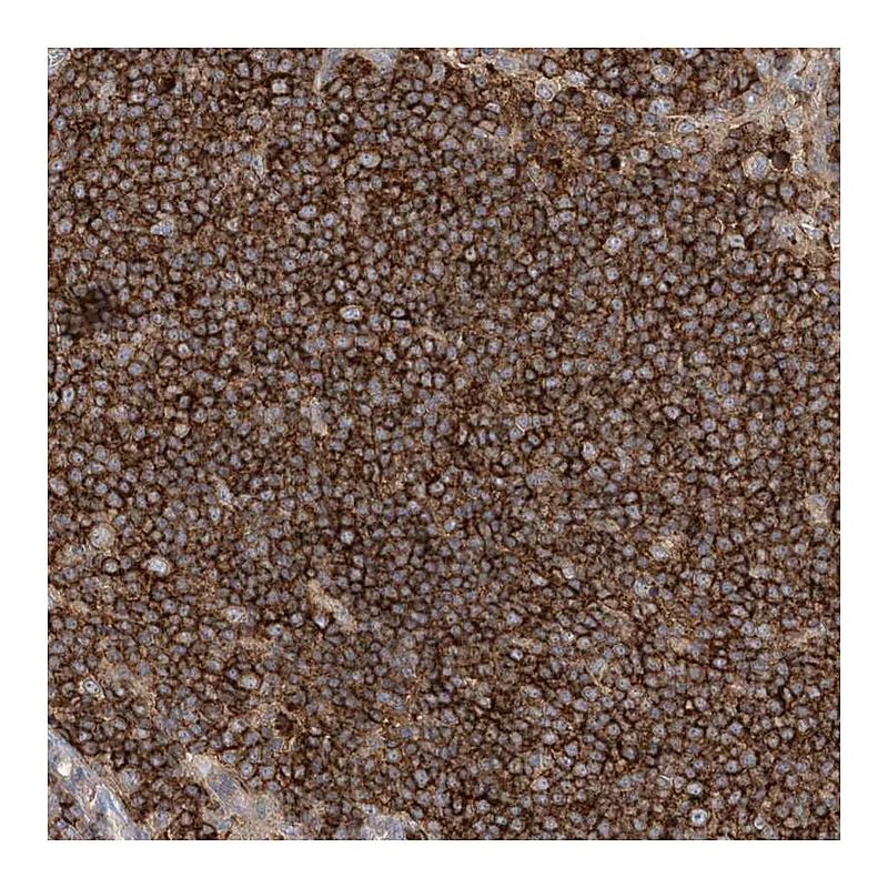 Atlas Antibodies Anti-IL1RAPL2 Antibody