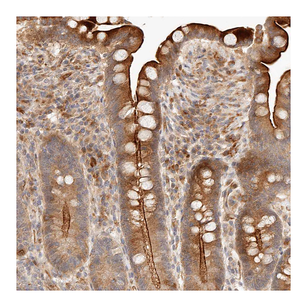 Atlas Antibodies Anti-IL1R2 Antibody