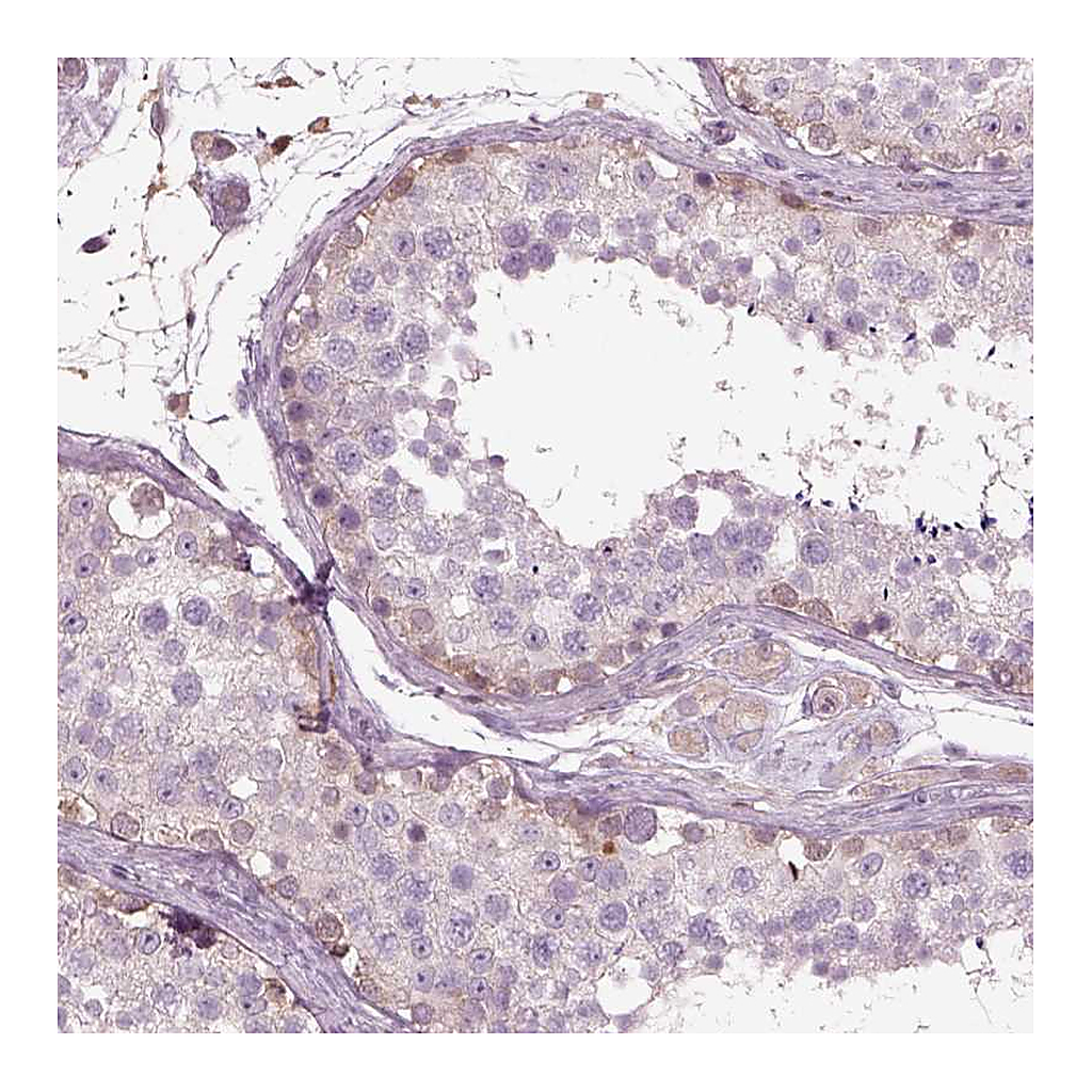 Atlas Antibodies Anti-IL31RA Antibody
