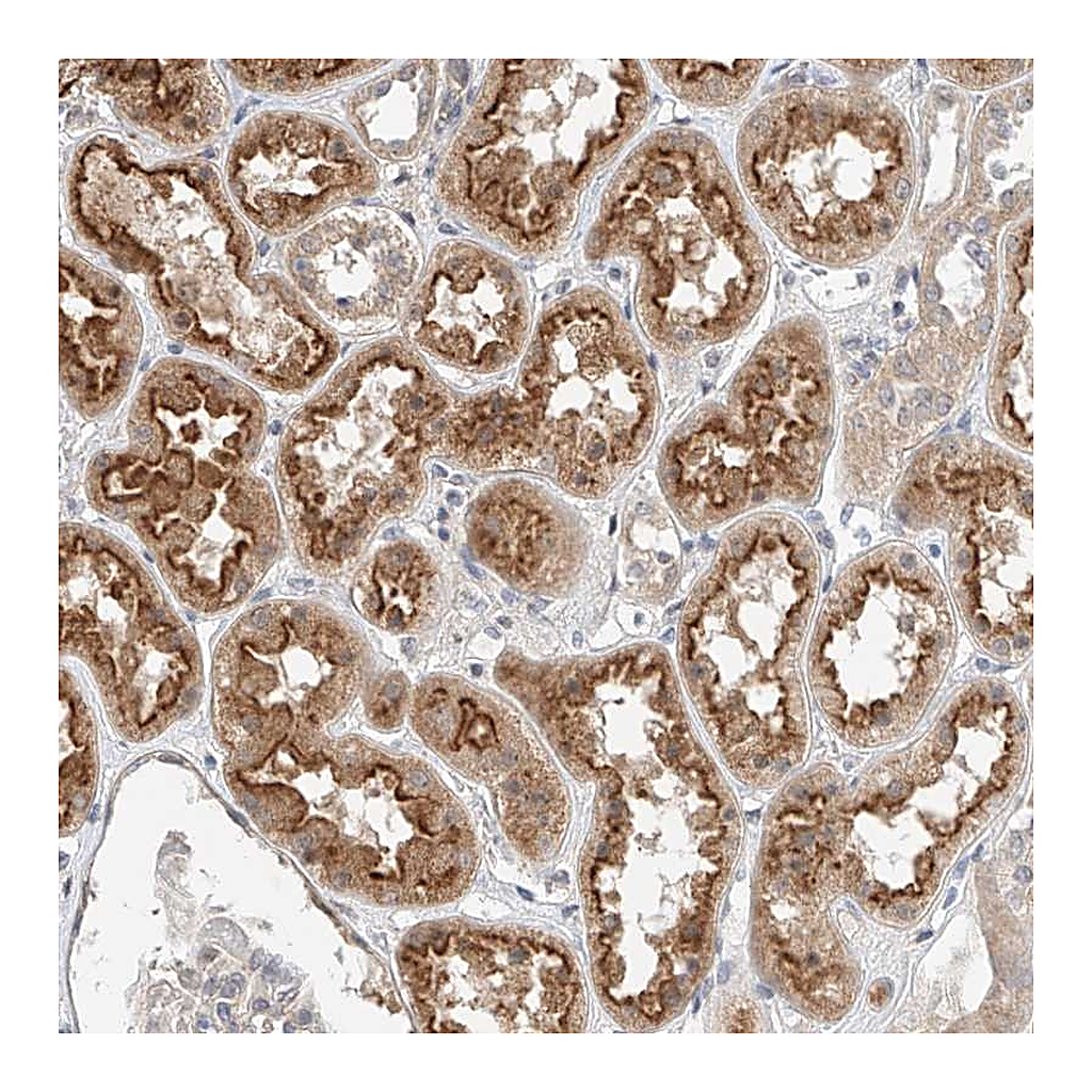 Atlas Antibodies Anti-IL22RA2 Antibody