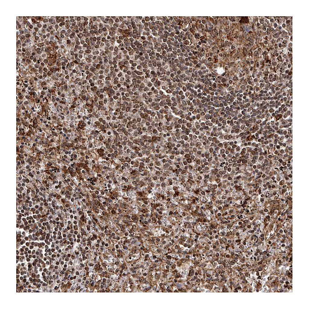 Atlas Antibodies Anti-IL32 Antibody