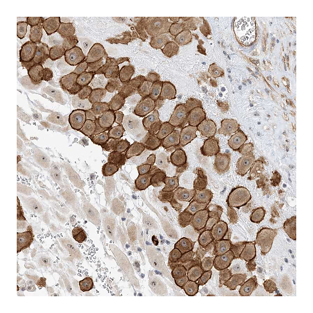 Atlas Antibodies Anti-IL36B Antibody