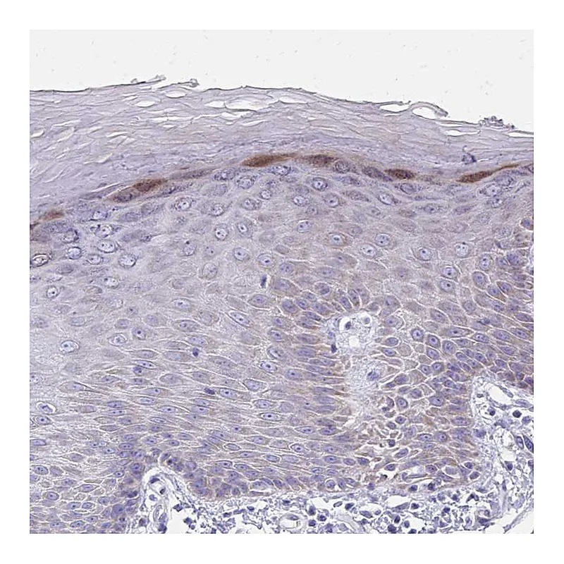 Atlas Antibodies Anti-IL37 Antibody