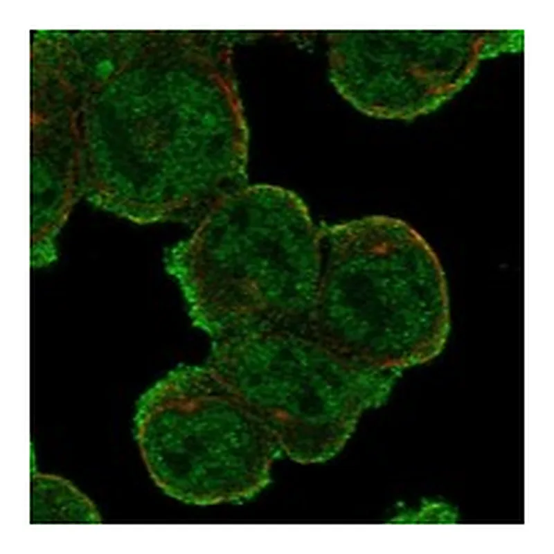 Atlas Antibodies Anti-IL4R Antibody