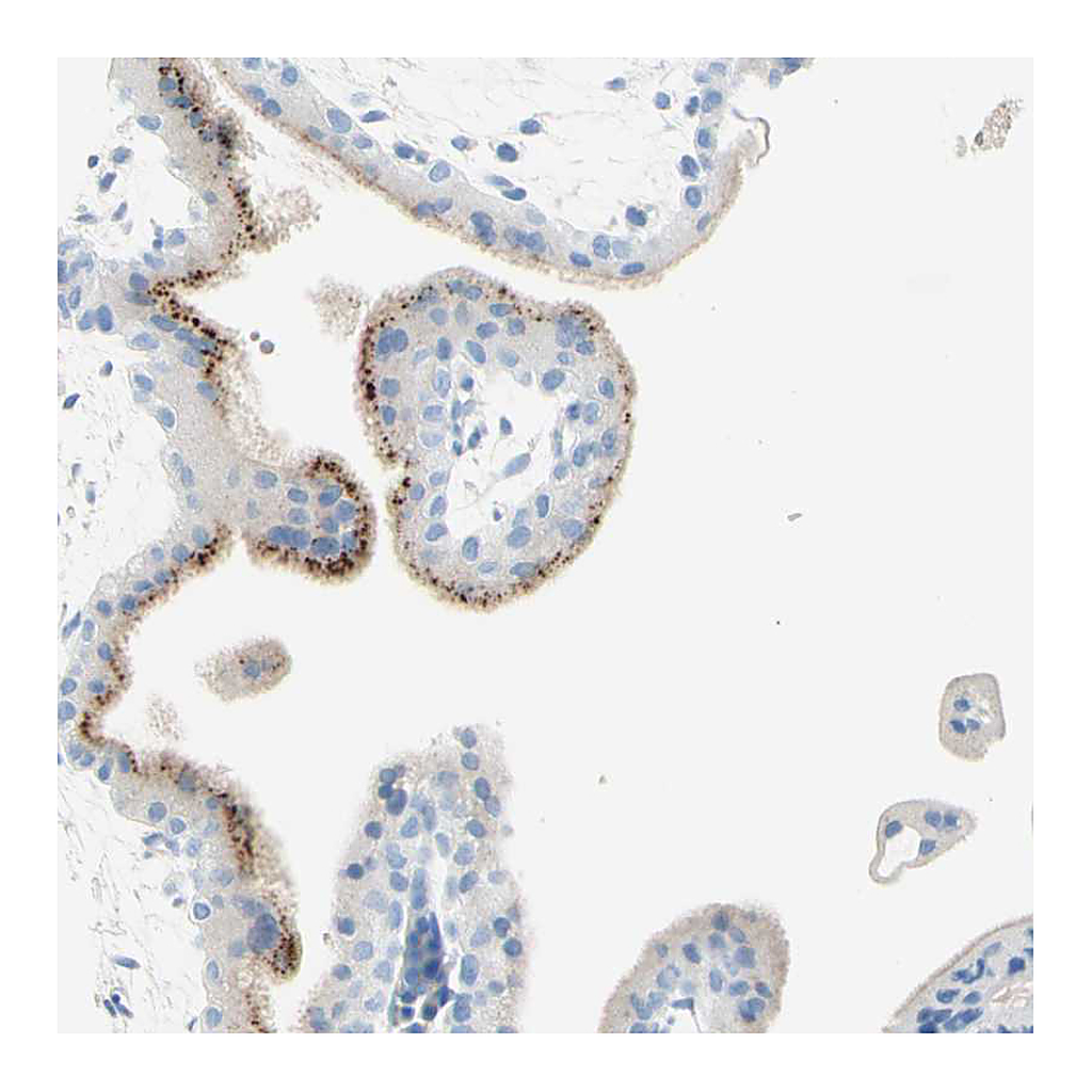 Atlas Antibodies Anti-IL6ST Antibody