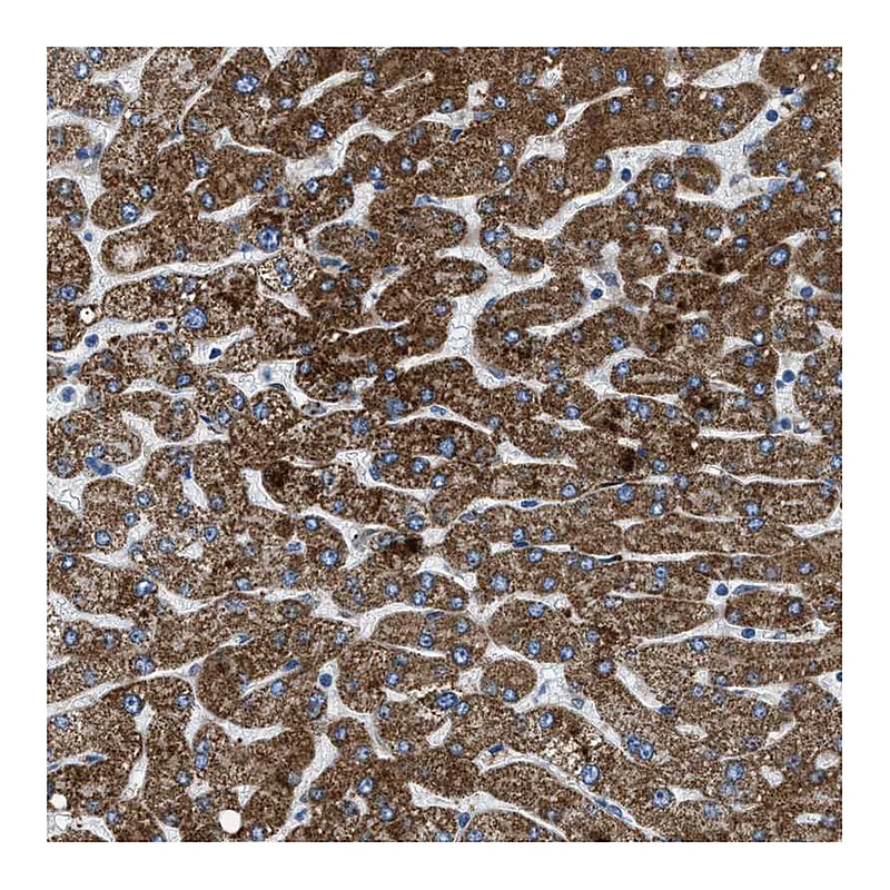 Atlas Antibodies Anti-ILDR1 Antibody