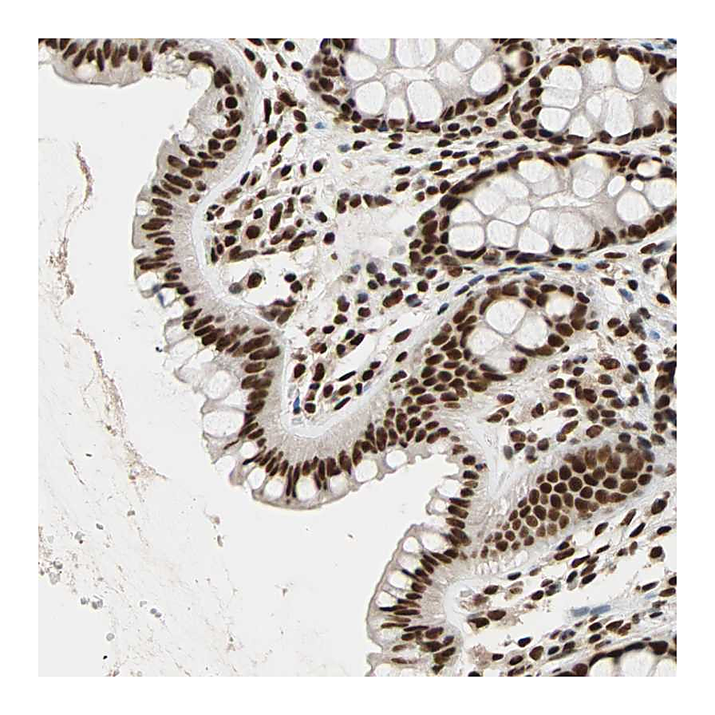 Atlas Antibodies Anti-ILF2 Antibody
