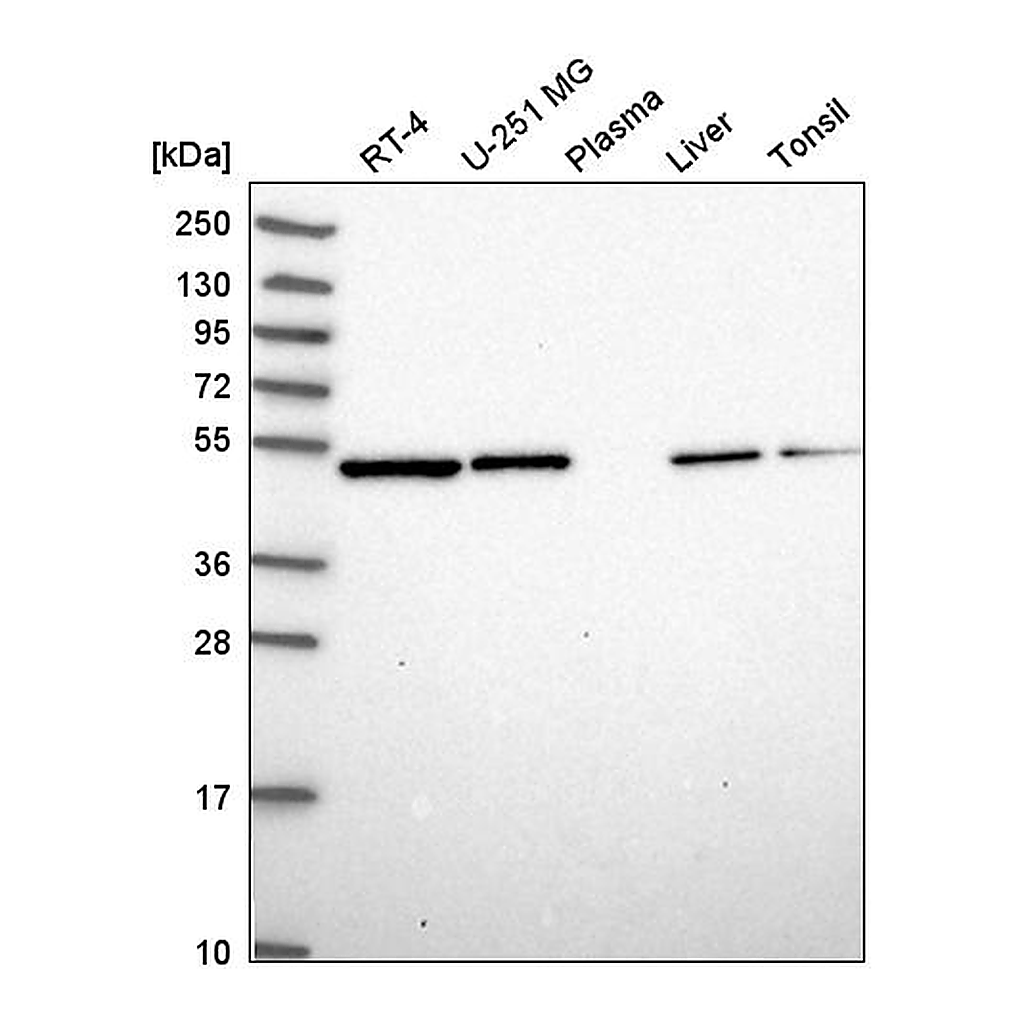 Atlas Antibodies Anti-ILK Antibody