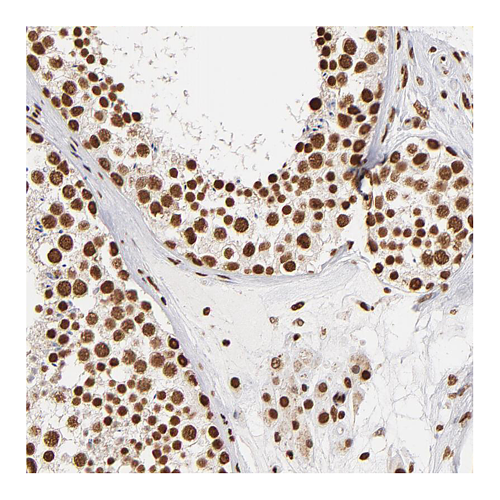 Atlas Antibodies Anti-ILF3 Antibody