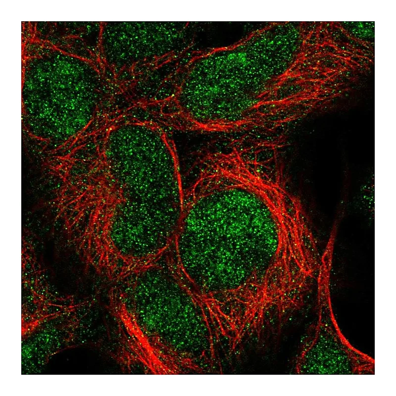 Atlas Antibodies Anti-IMP3 Antibody