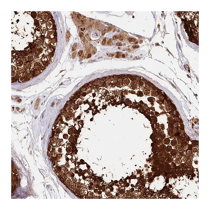 Atlas Antibodies Anti-IMPA1 Antibody
