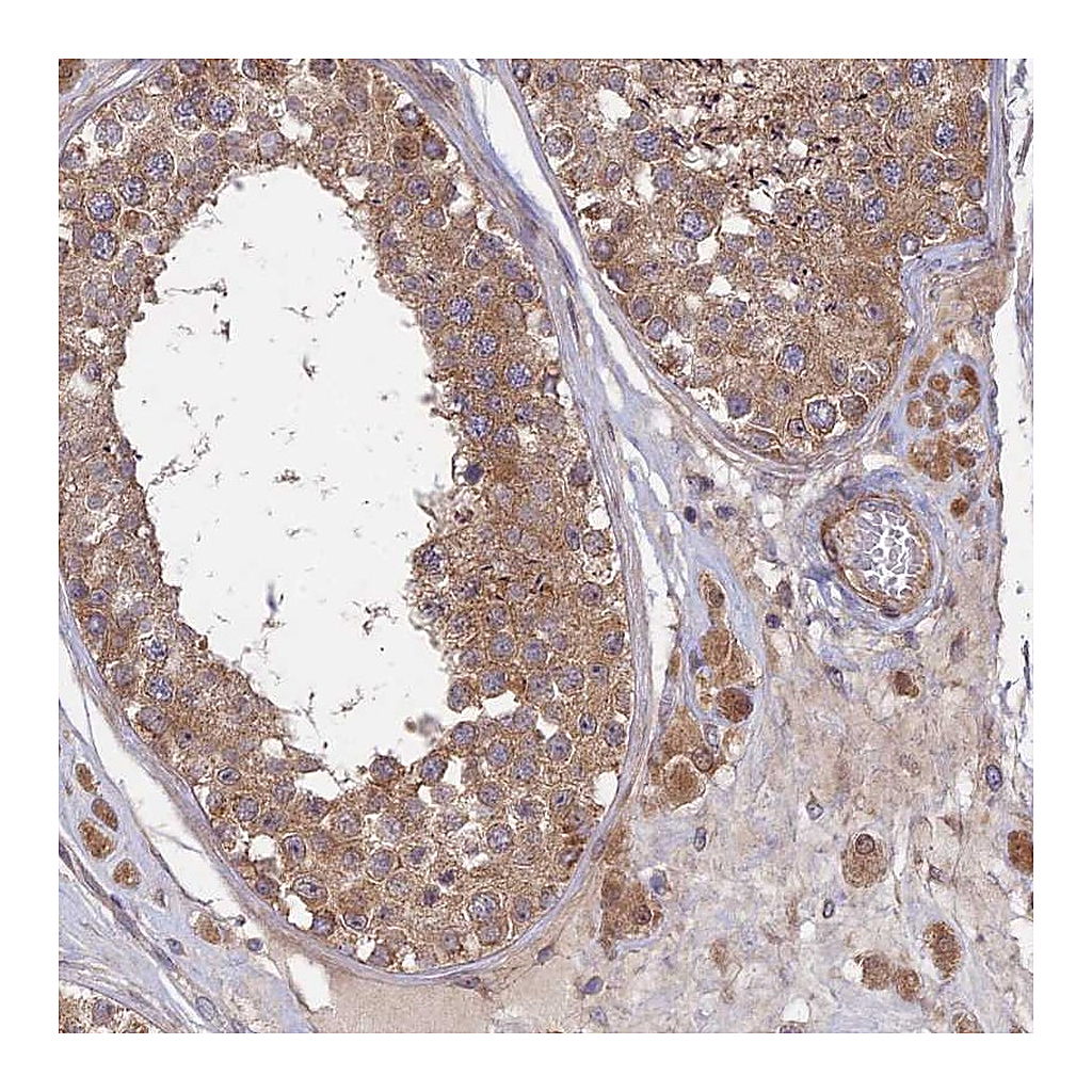 Atlas Antibodies Anti-INCA1 Antibody