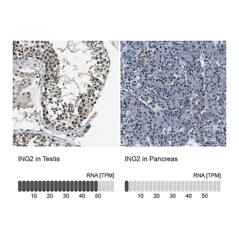 Atlas Antibodies Anti-ING2 Antibody