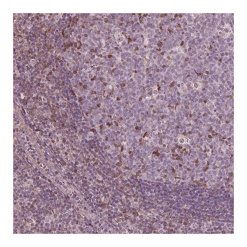Atlas Antibodies Anti-ING3 Antibody