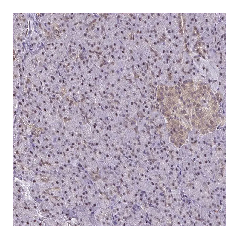 Atlas Antibodies Anti-ING4 Antibody