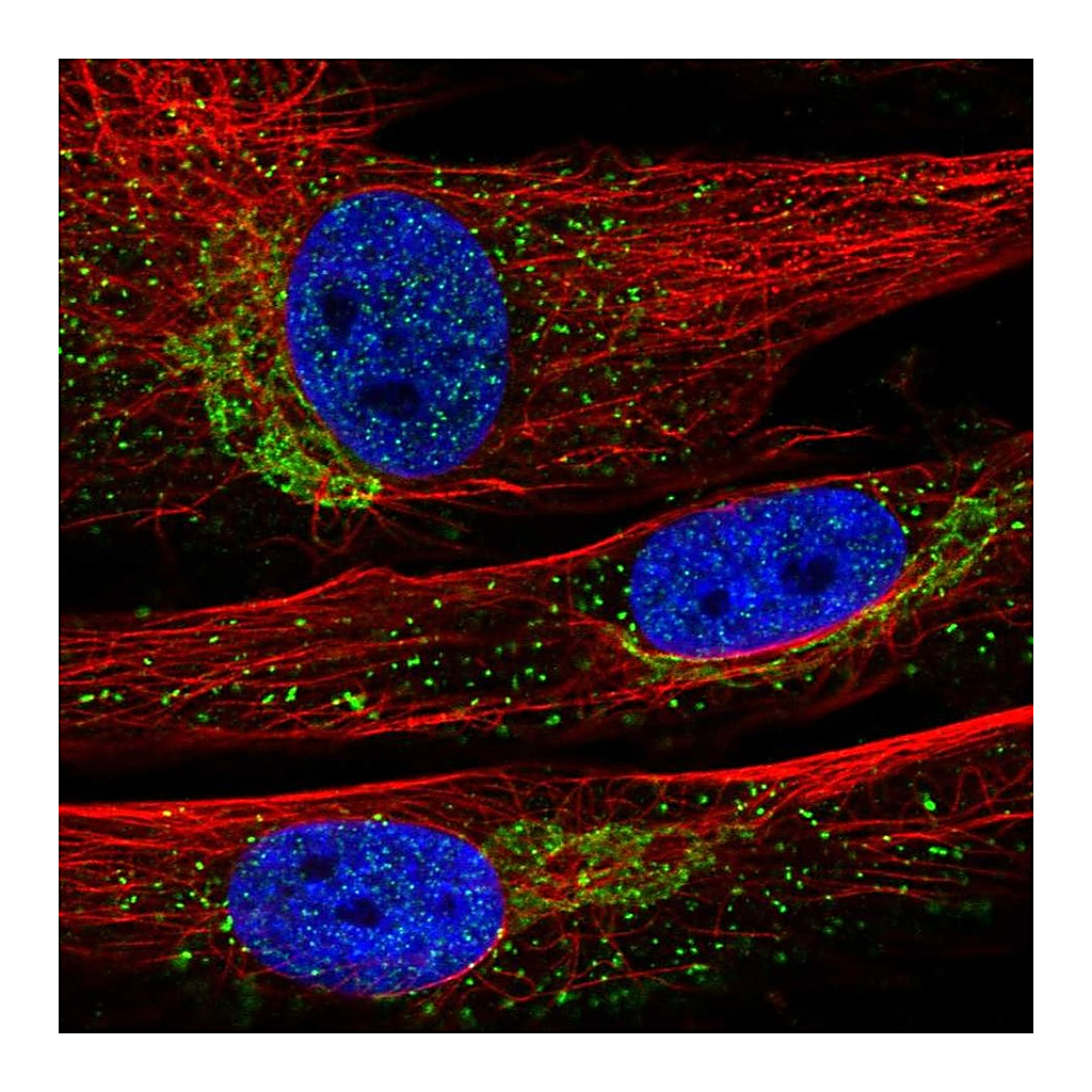 Atlas Antibodies Anti-INMT Antibody