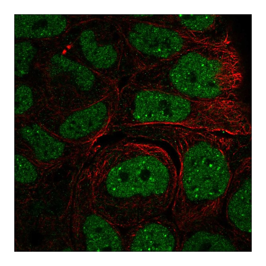 Atlas Antibodies Anti-INO80 Antibody