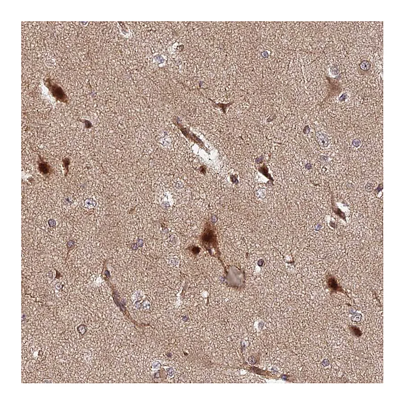 Atlas Antibodies Anti-INO80D Antibody