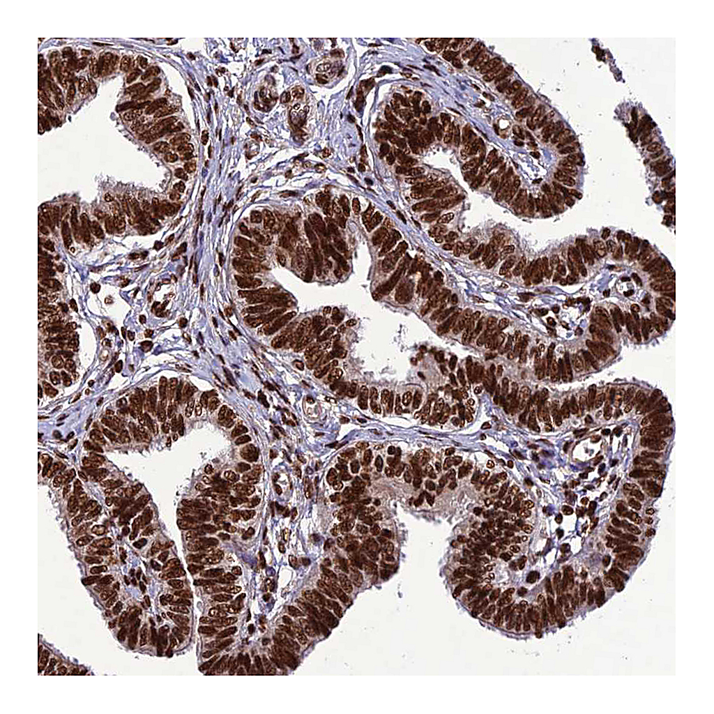 Atlas Antibodies Anti-INO80E Antibody