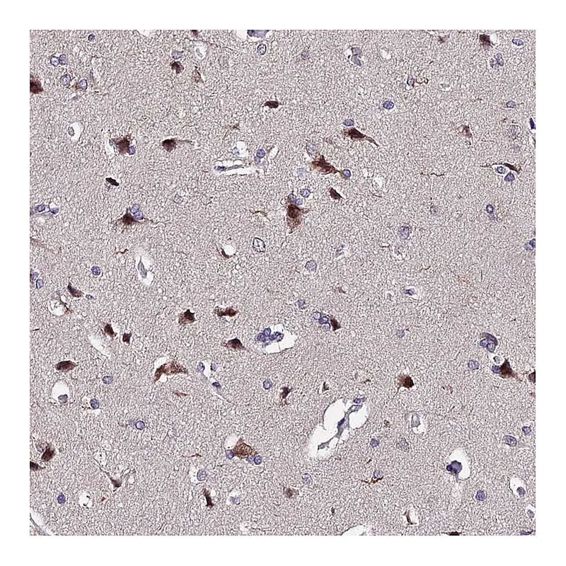 Atlas Antibodies Anti-INPP4A Antibody