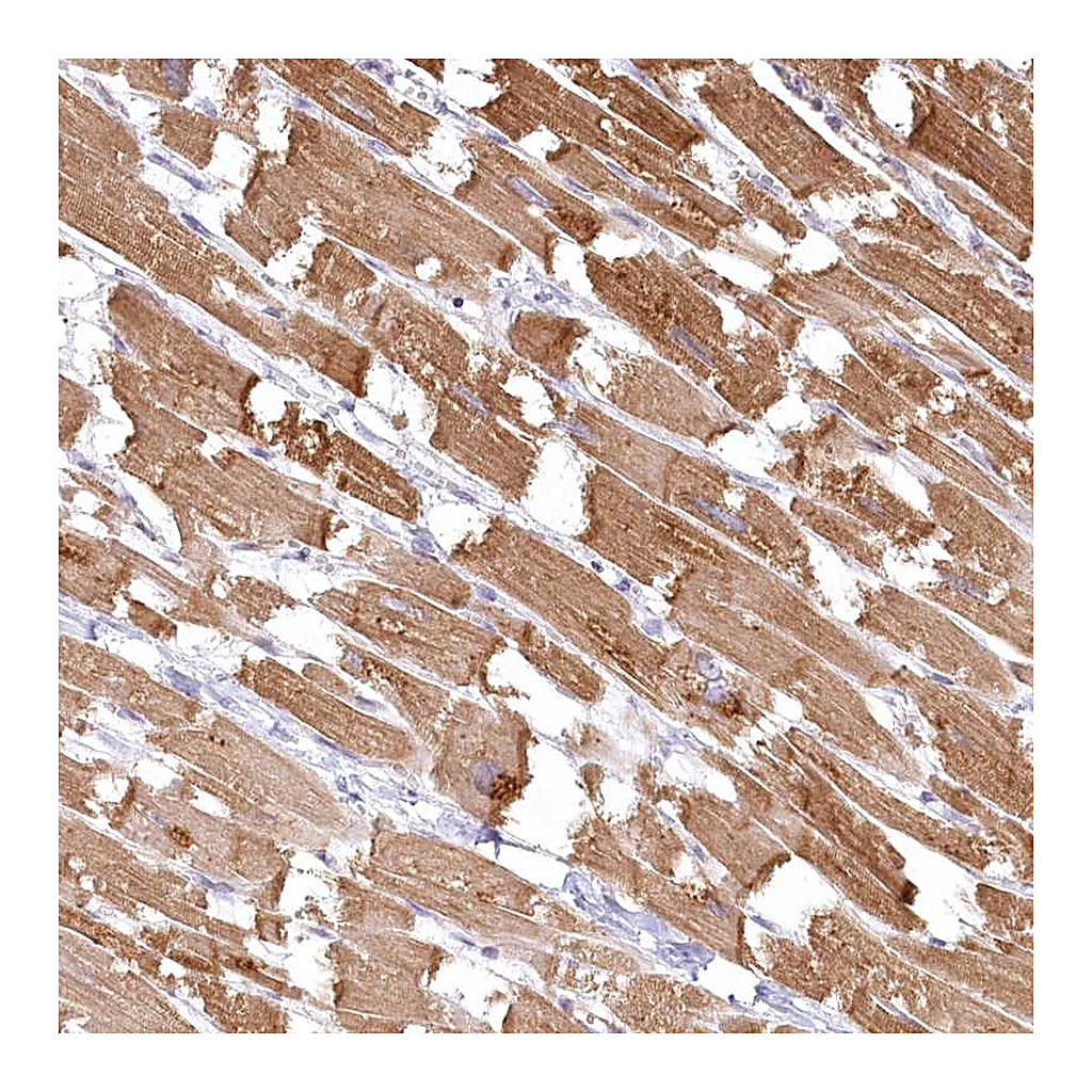 Atlas Antibodies Anti-INPP4B Antibody