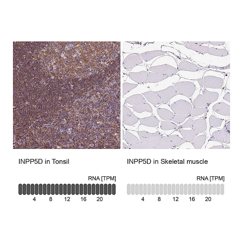 Atlas Antibodies Anti-INPP5D Antibody