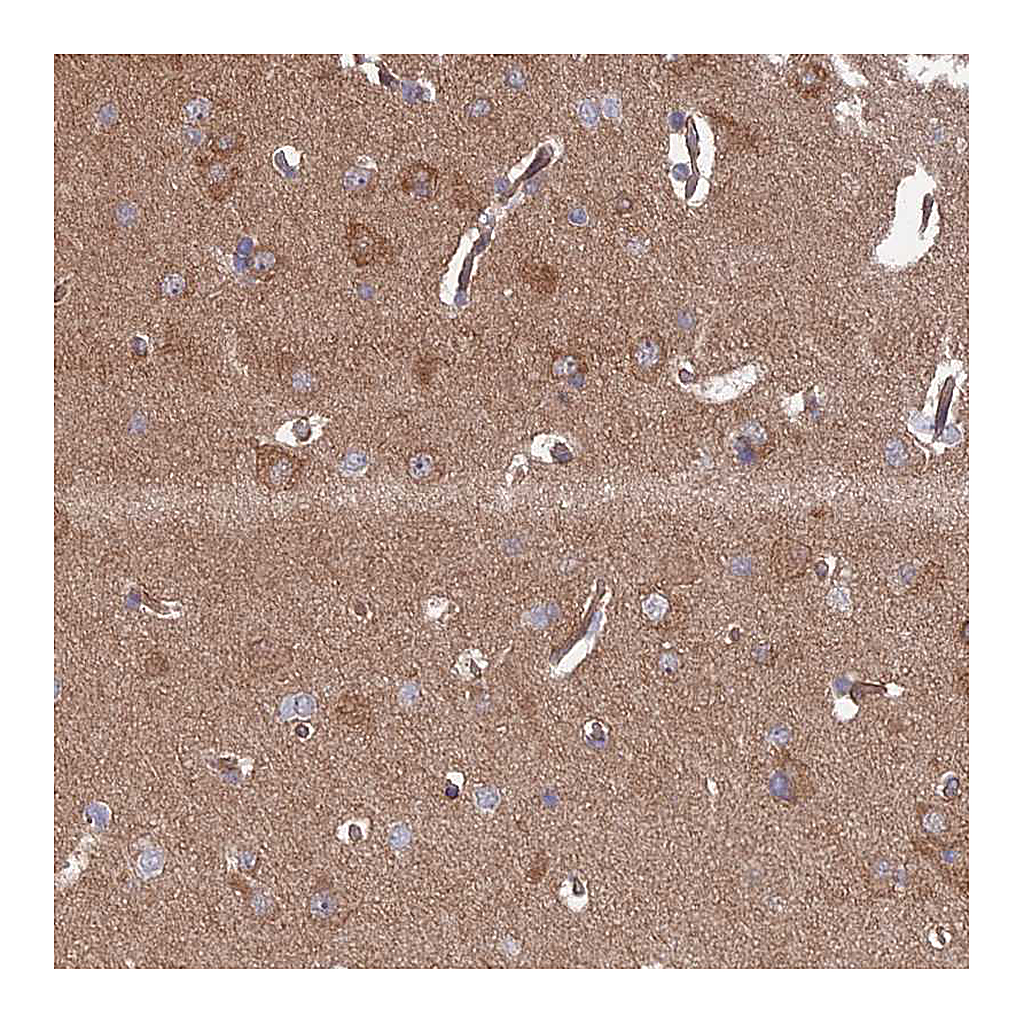 Atlas Antibodies Anti-INSM2 Antibody
