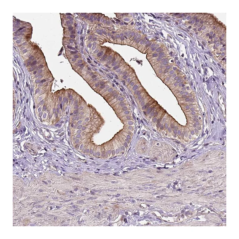 Atlas Antibodies Anti-INPP5E Antibody