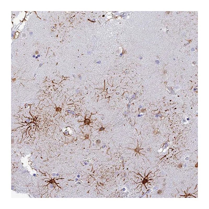 Atlas Antibodies Anti-INTS13 Antibody