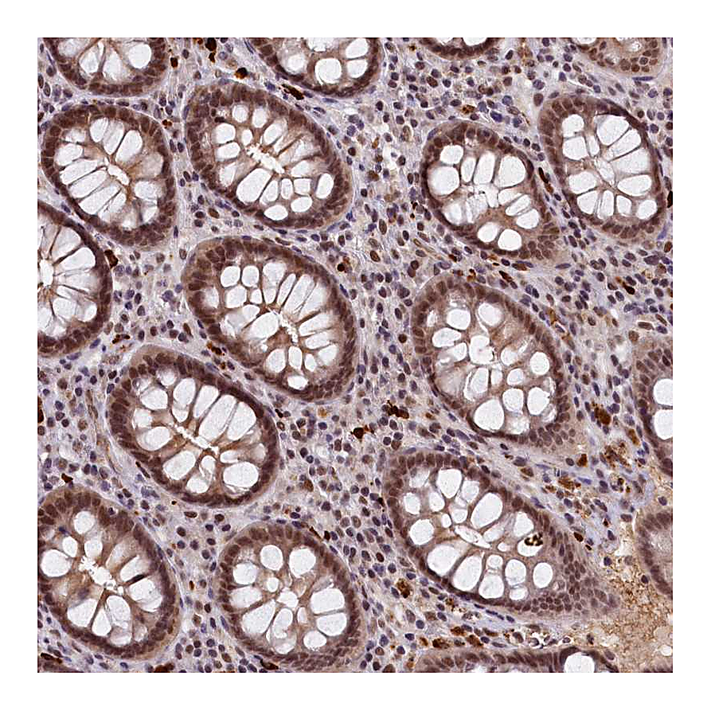 Atlas Antibodies Anti-INTS14 Antibody