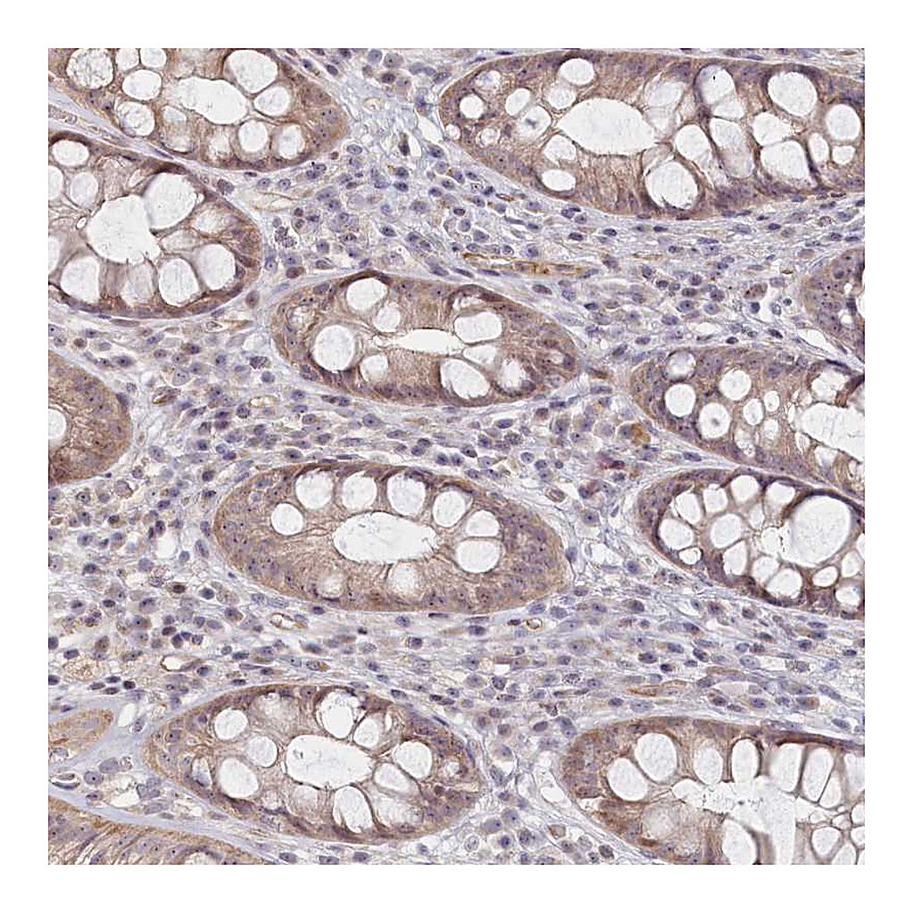 Atlas Antibodies Anti-INTS4 Antibody