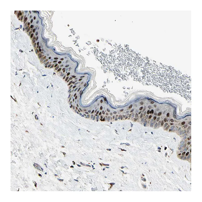 Atlas Antibodies Anti-IP6K2 Antibody
