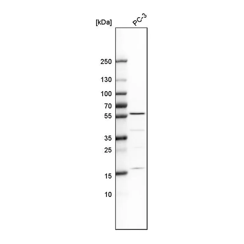 Atlas Antibodies Anti-IP6K1 Antibody