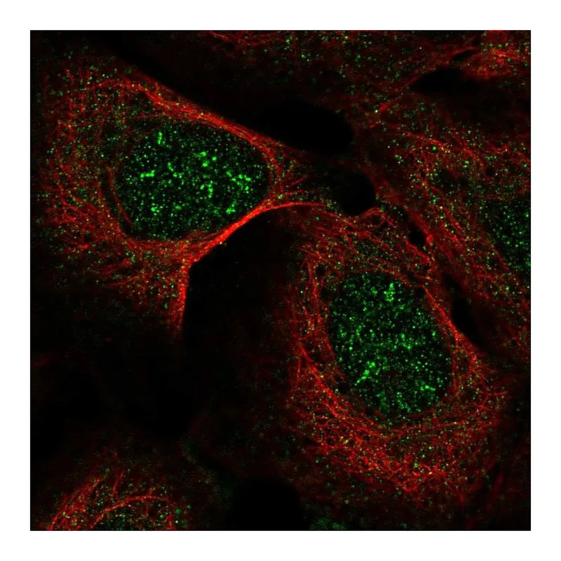 Atlas Antibodies Anti-IP6K2 Antibody