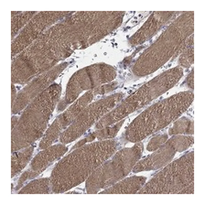 Atlas Antibodies Anti-IP6K3 Antibody