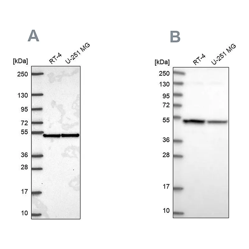 Atlas Antibodies Anti-IPO4 Antibody