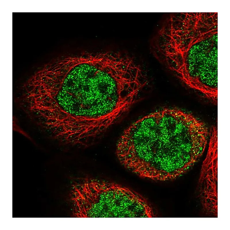Atlas Antibodies Anti-IPMK Antibody