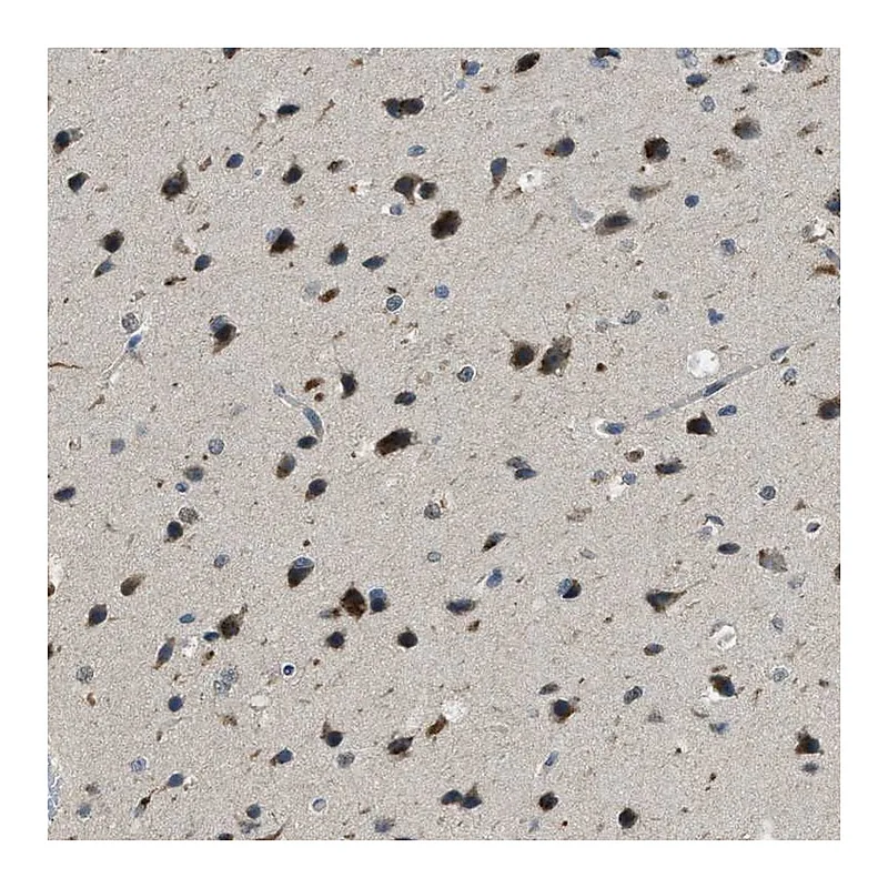 Atlas Antibodies Anti-IPO7 Antibody