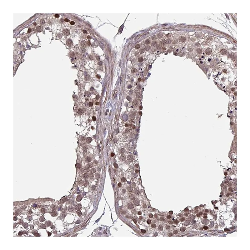 Atlas Antibodies Anti-IPO5 Antibody