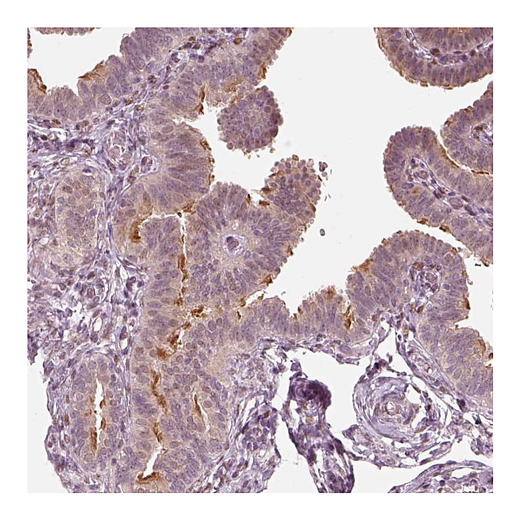 Atlas Antibodies Anti-IQCB1 Antibody