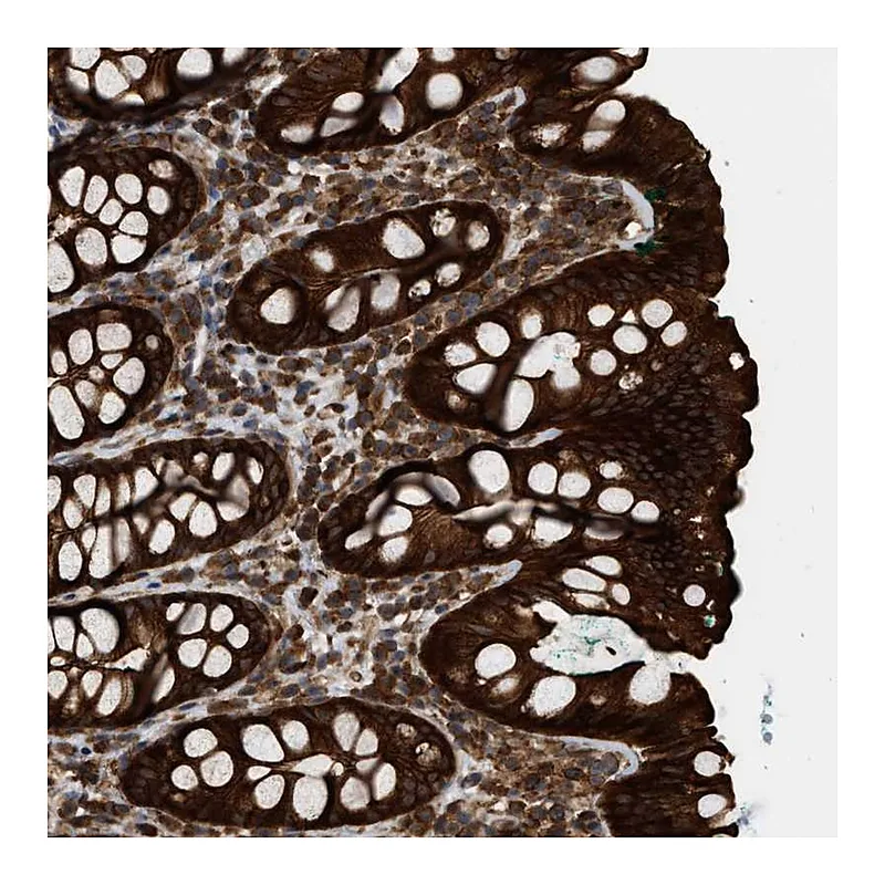 Atlas Antibodies Anti-IQCE Antibody